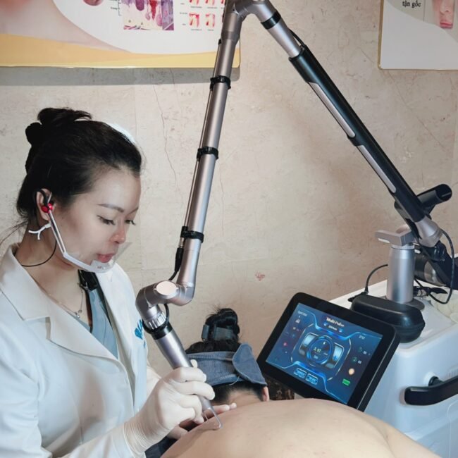 Đặc trị mụn lưng CNC Laser