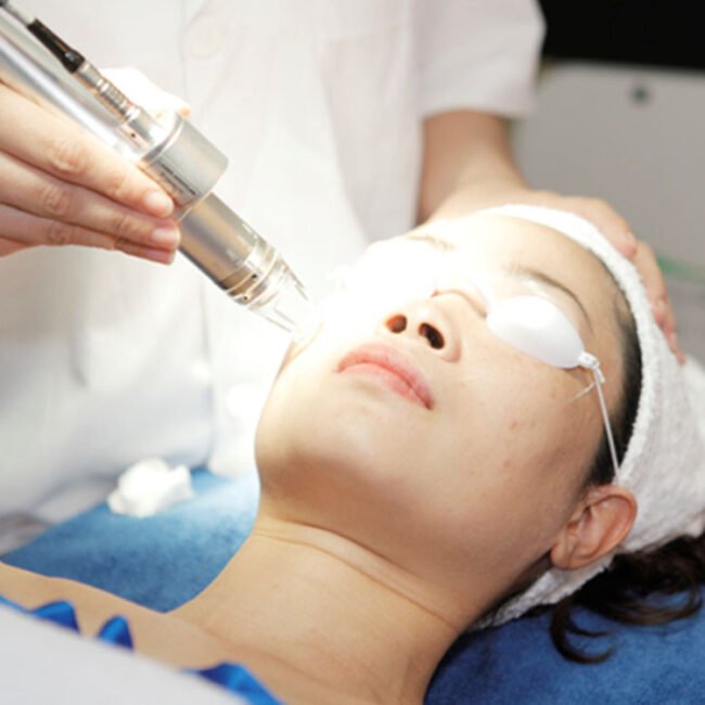 Đặc trị Seo CNC Laser tại Seishin Beauty Hà Nội