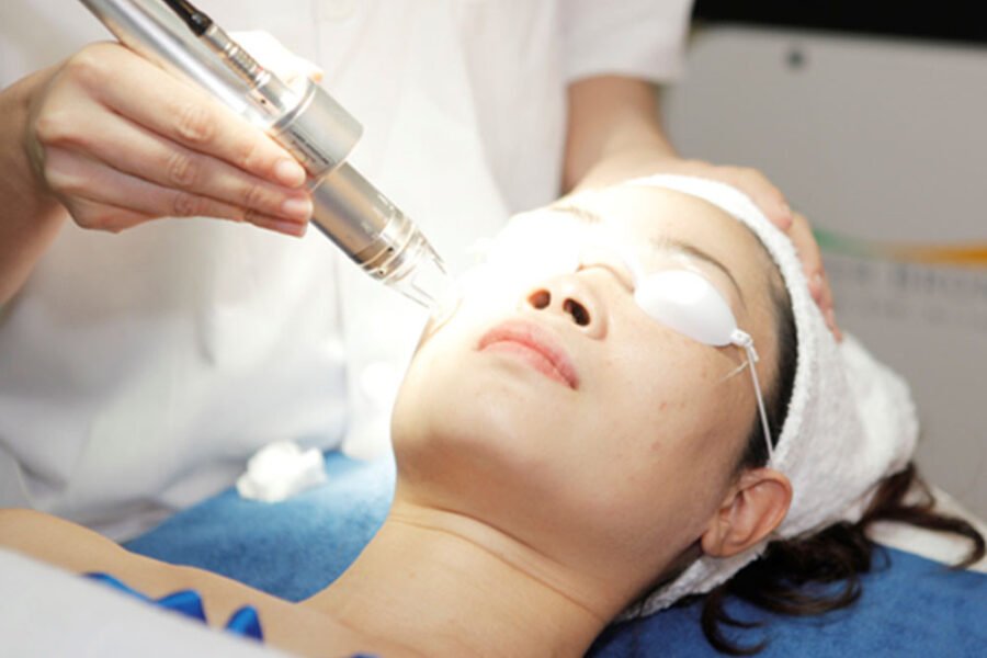 Đặc trị Seo CNC Laser tại Seishin Beauty Hà Nội